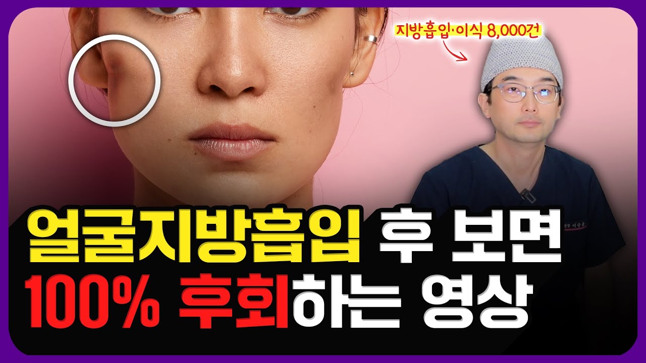 얼굴지방흡입에 대해 솔직하게 말씀드립니다. | 시술 부위, 효과, 붓기, 멍, 경과, 부작용