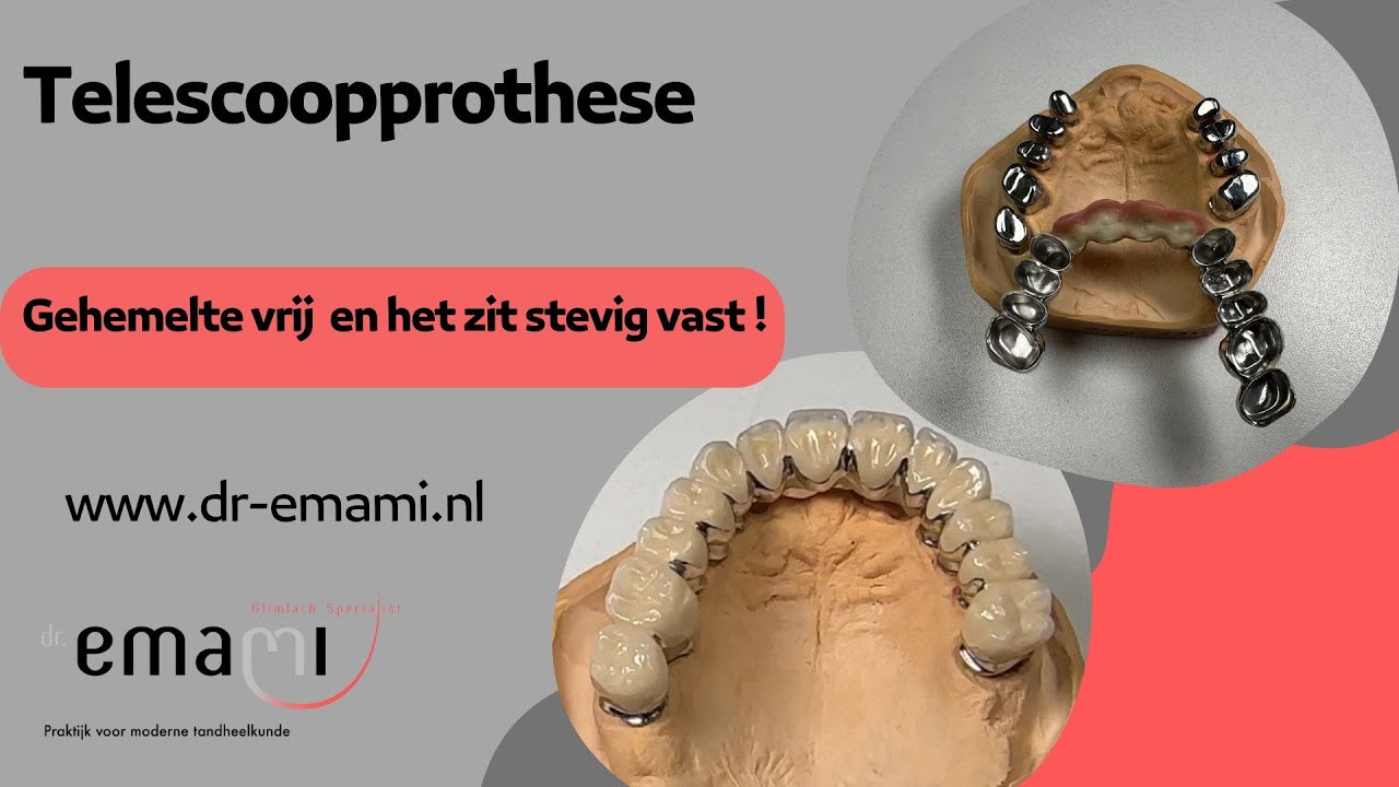 Frame of telescoop-prothese