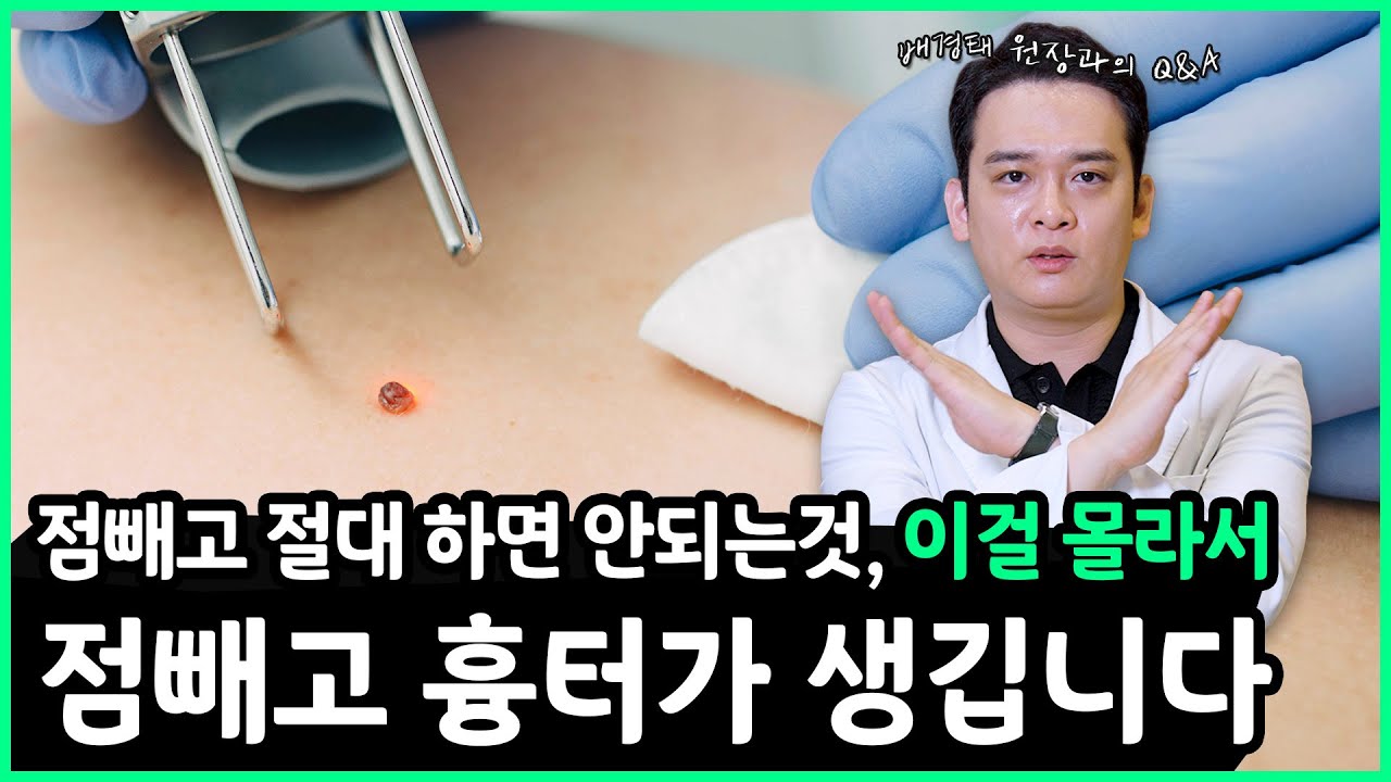점빼고 이렇게 안하면 100% 흉터 색소침착 생깁니다!