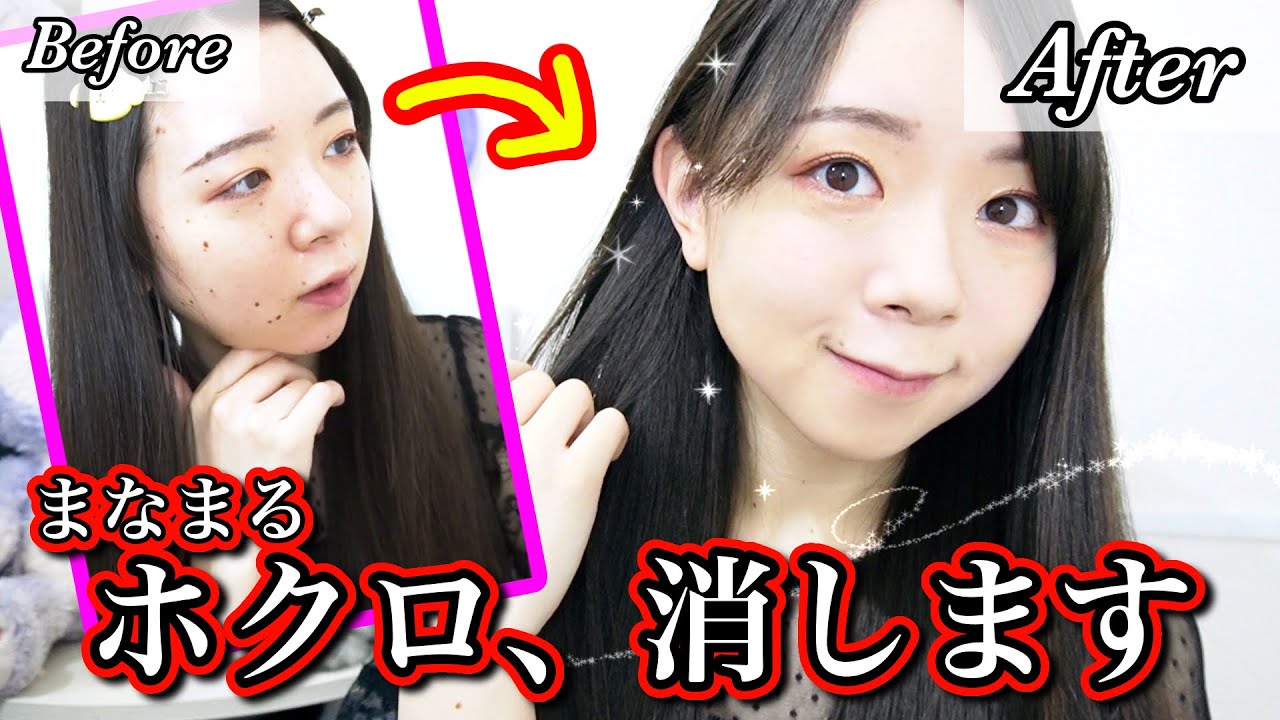 【メイク】ほくろが全部消えました【まなまる】