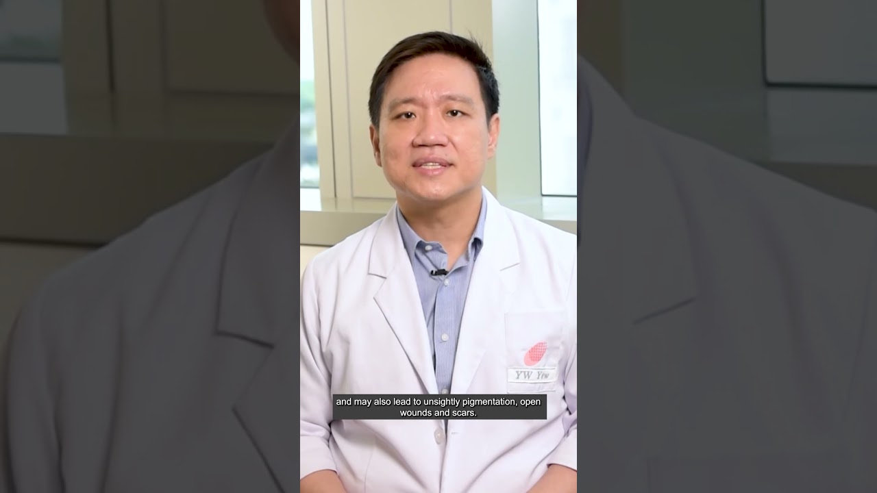Understanding Eczema
