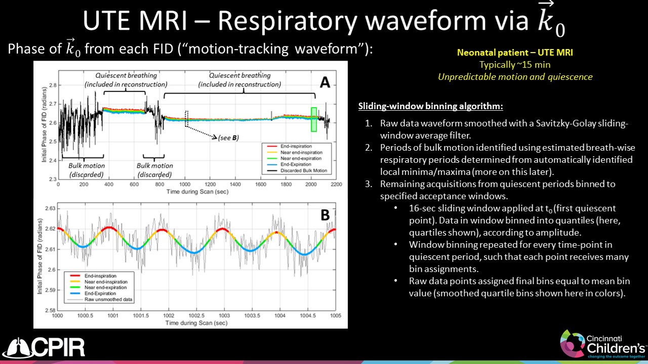 Nara Higano: Retrospective respiratory self-gating and removal of bulk motion