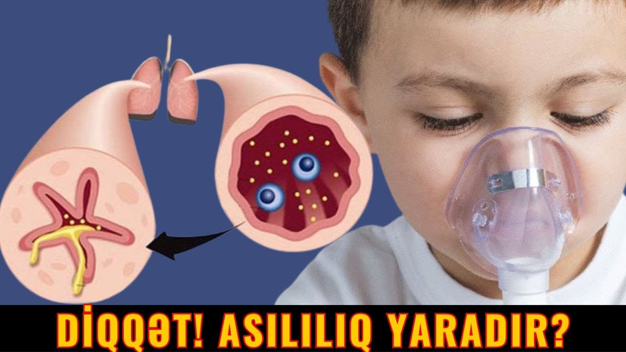 İNQALYASİYANIN Yan Təsirləri Hansılardır?