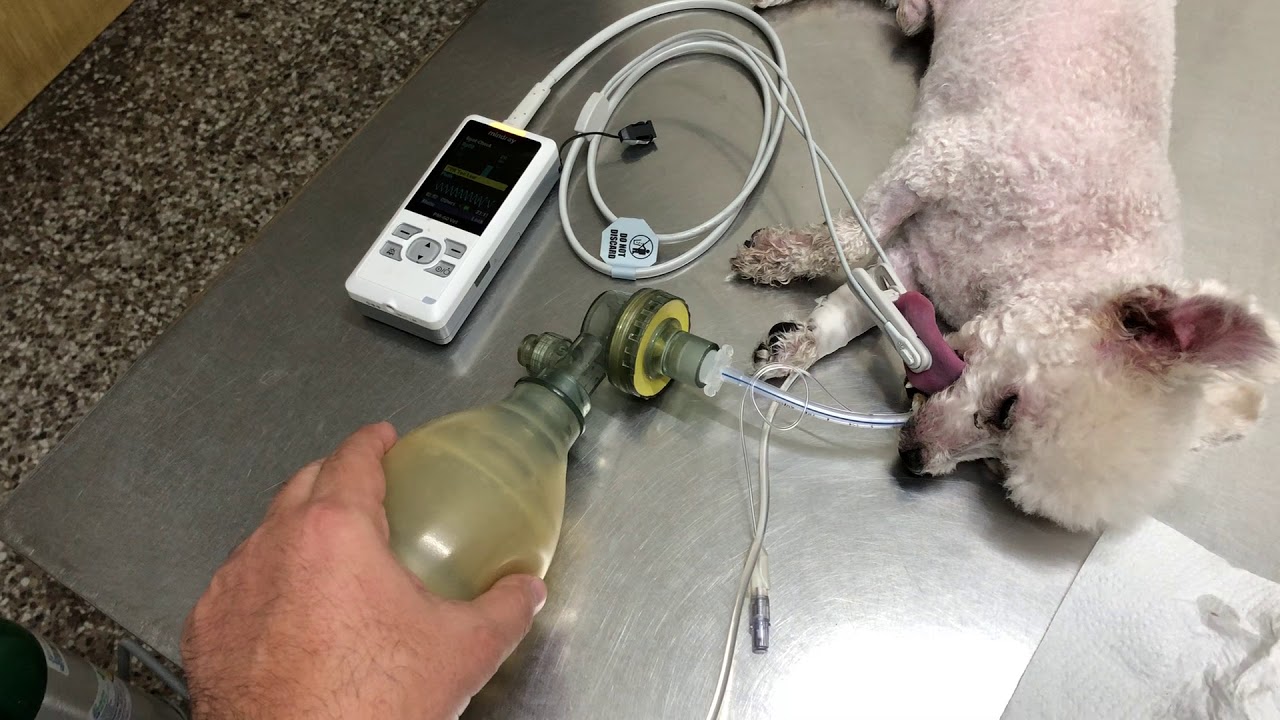 Ventilación por VPPI inmediato a la inducción de la anestesia con propofol