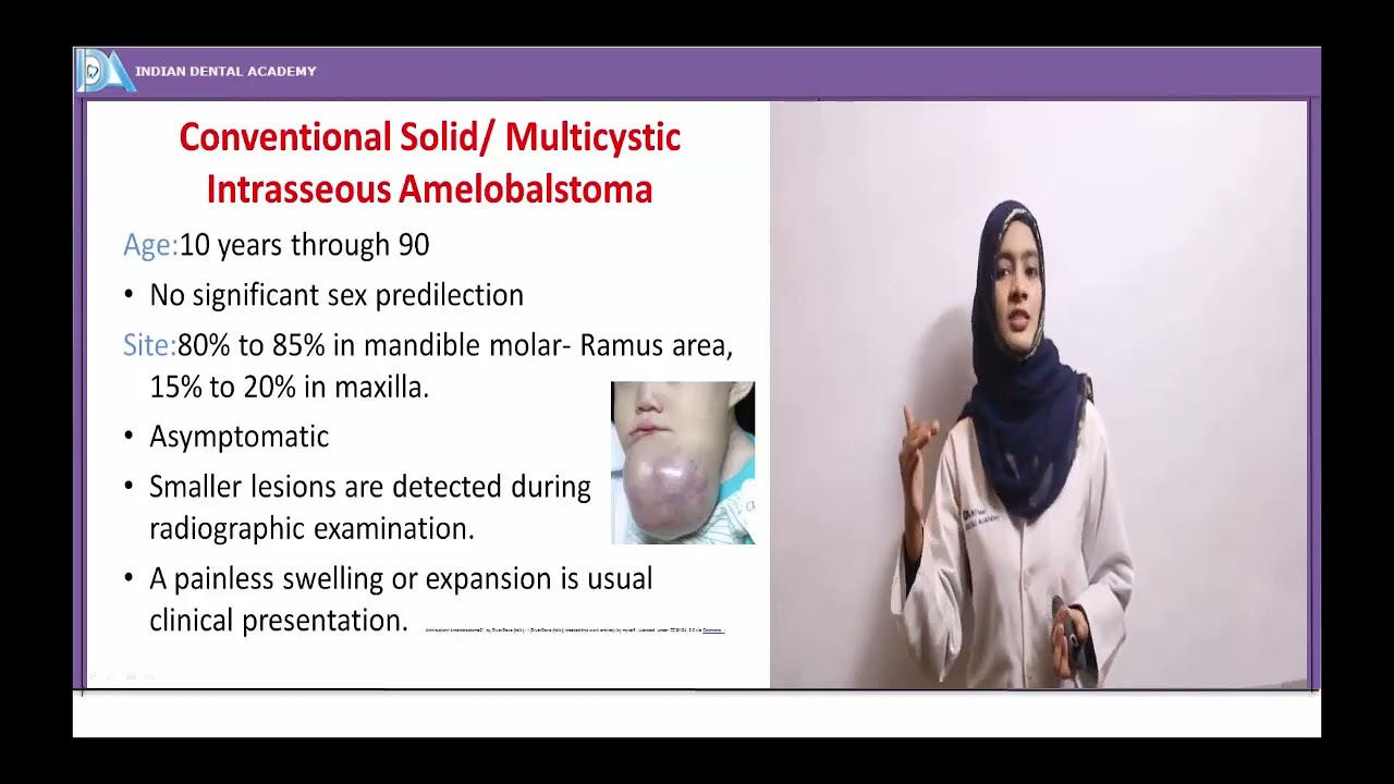 Odontogenic tumors #ORE#NEET#INDIANDENTALACADEMY