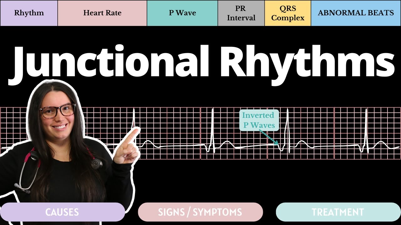 Junctional Rhythms on an EKG with Qs | Circulatory System and Disease | NCLEX-RN | Nurse Cheung