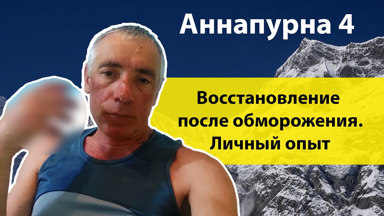 Моя битва с обморожением. Путь к выздоровлению.