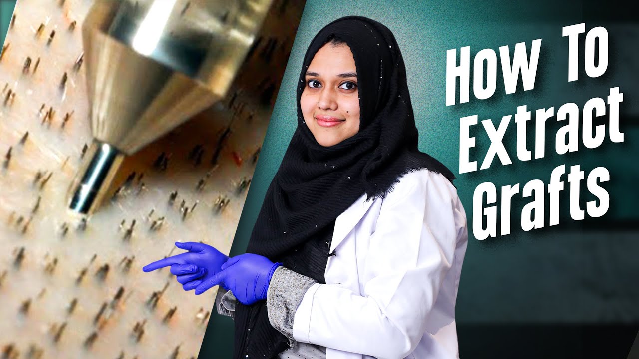 Graft Extraction in Hair Transplant: Techniques and Procedures 🧐 | Bangladesh | New Roots