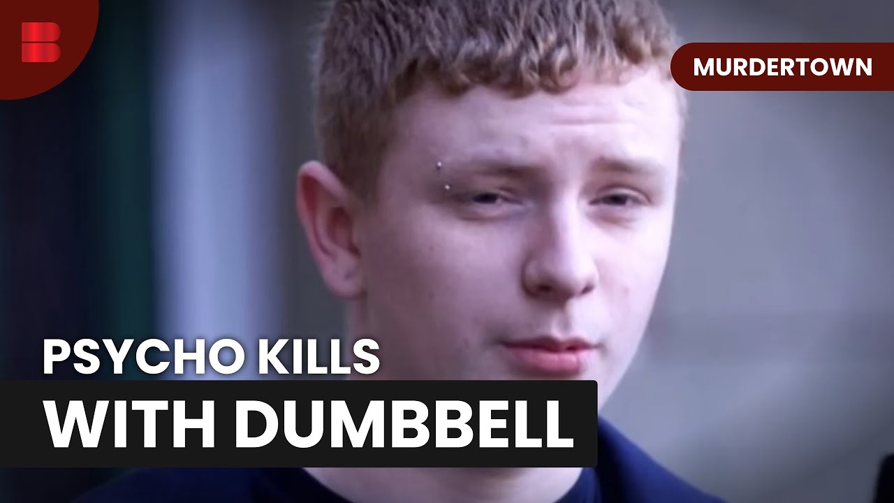Stranger Attacks Dog Walker With Dumbbell in Dundee