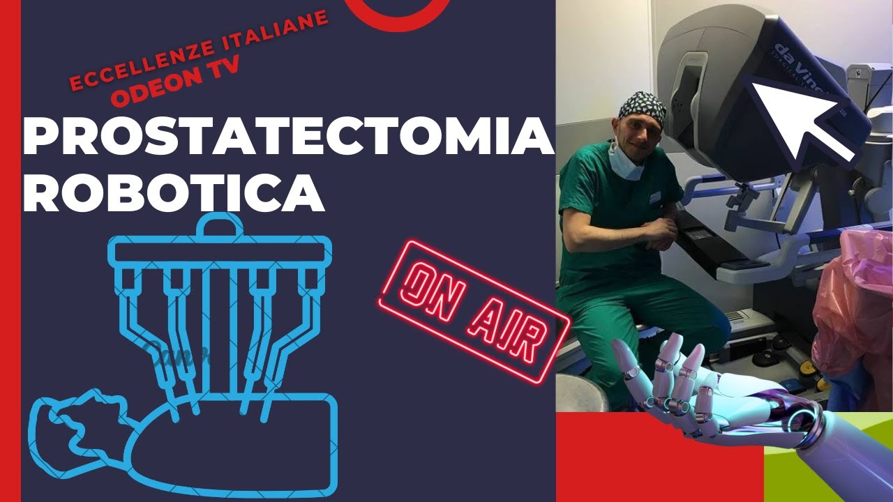 Prostatectomia robotica per  carcinoma prostatico: come si svolge l intervento.