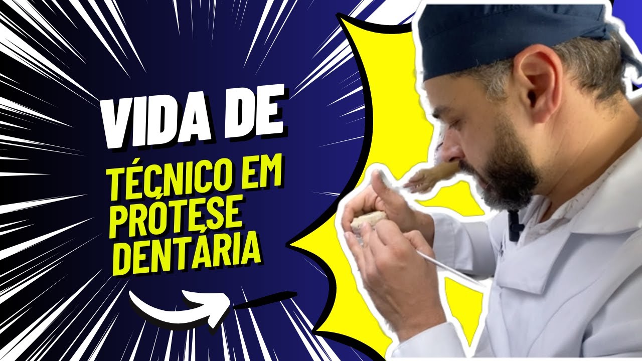 Tudo que você precisa saber antes de inicar na Vida de técnico de prótese.