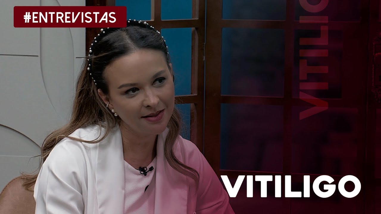 Saiba tudo sobre o vitiligo