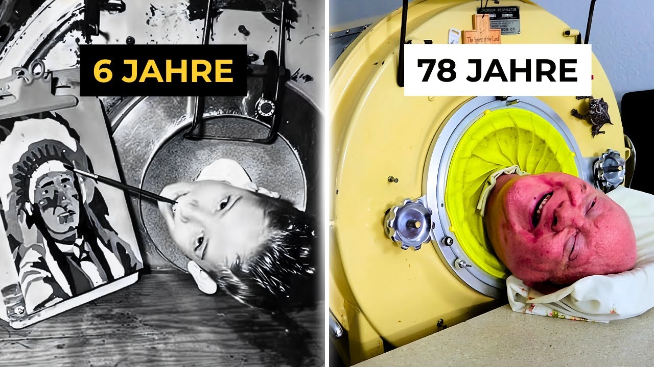 Der Mann, der 72 JAHRE in einer Eisernen Lunge lebte