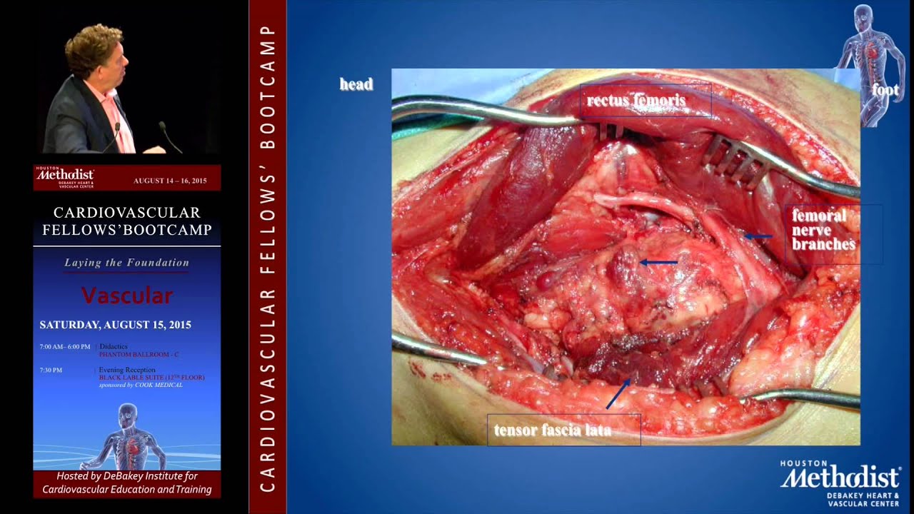 Diagnosis and Management of AVMs (Alan B. Lumsden, MD)