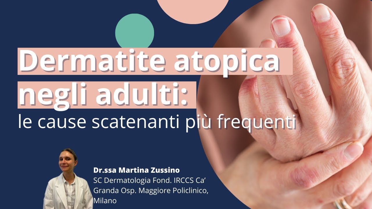 Dermatite atopica negli adulti: le cause scatenanti più frequenti | Derma-Point