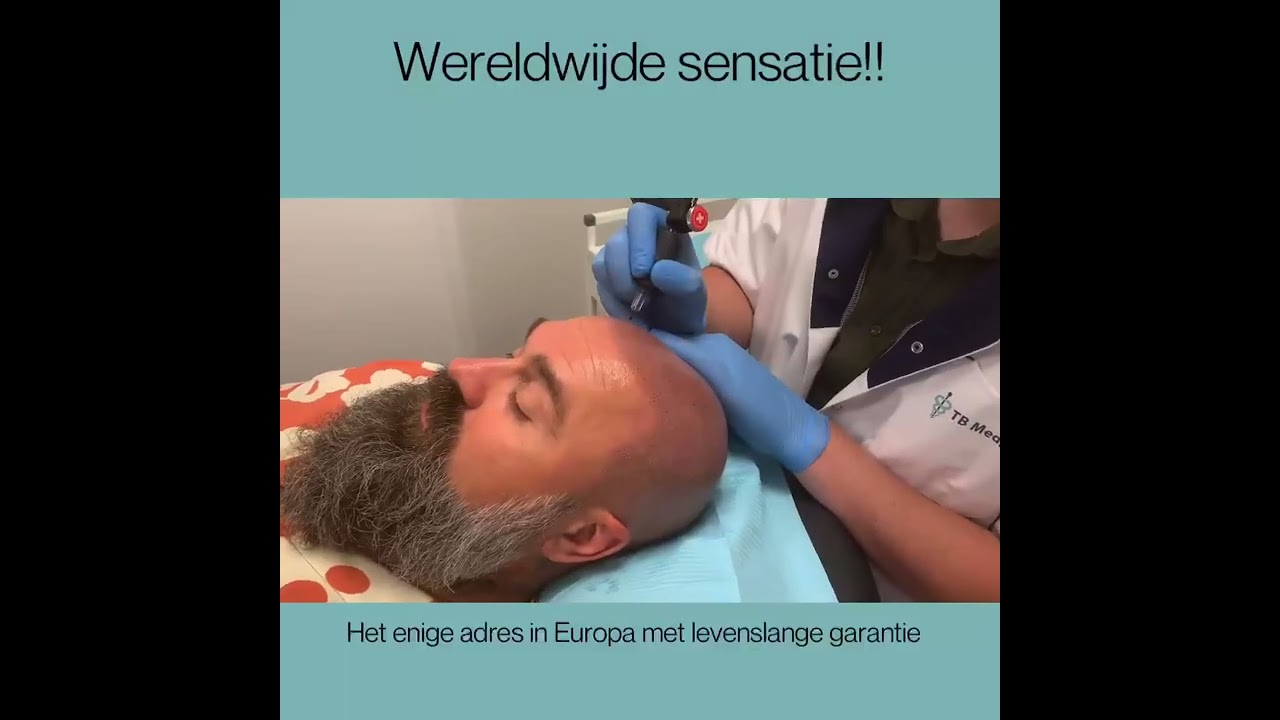 De enige echte stoppeldokter van Nederland! micro haar pigmentatie kaalheid