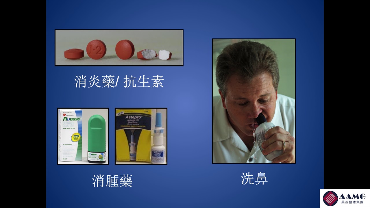鼻竇炎 | 耳鼻喉科講座 | AAMG