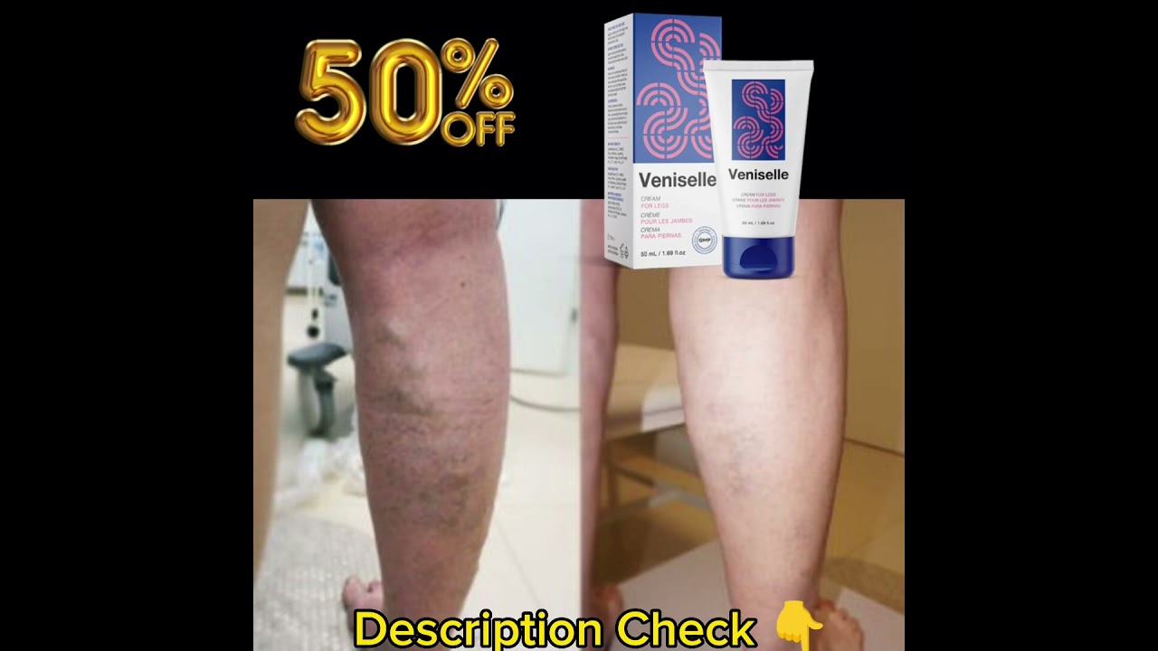 Veniselle, a new cream, claims it can help ease the pain of varicose veins. #Veniselle