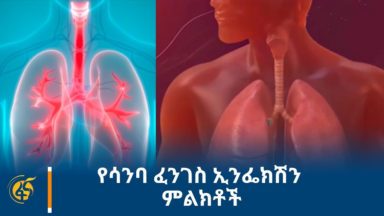 የሳንባ ፈንገስ ኢንፌክሽን ምልክቶች