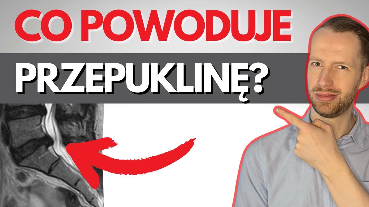 Od czego jest PRZEPUKLINA⁉️ Dlaczego powstaje⁉️ - Dyskopatia, rwa kulszowa, lumbago