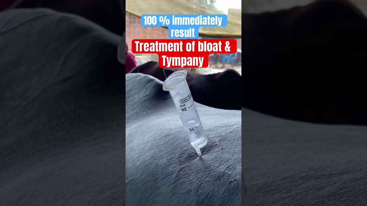 Bloat l Tympany l Dr Umar Khan