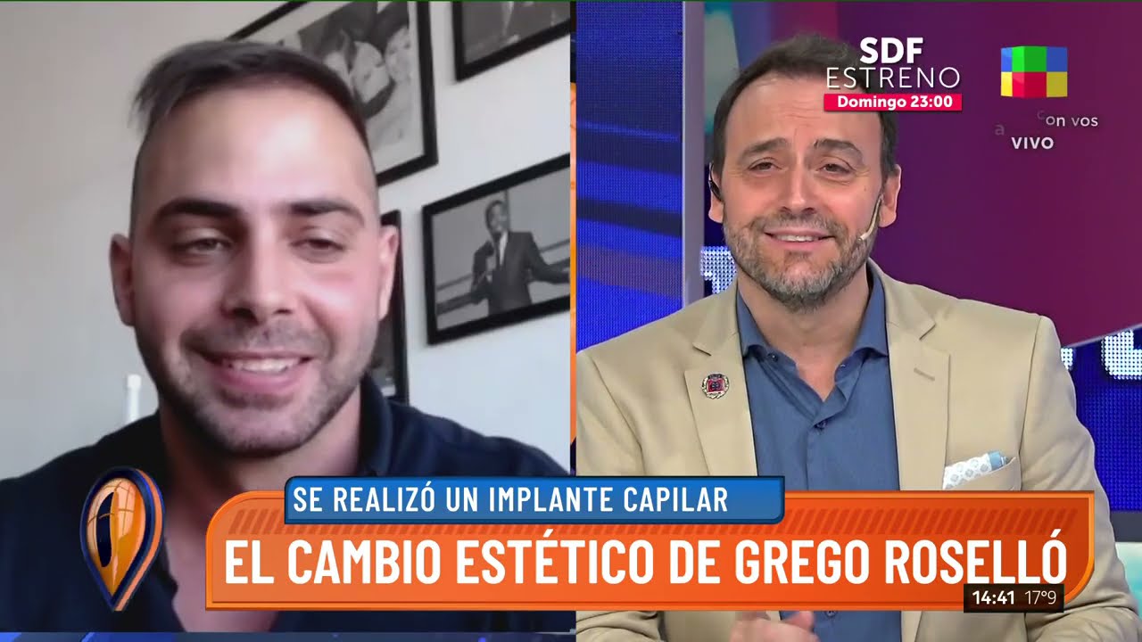 Grego Rossello reveló que se hizo un implante capilar: 