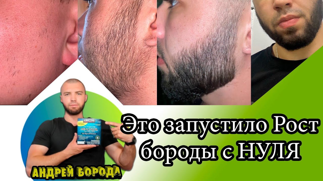 Это поможет запустить рост бороды с нуля / Андрей Борода / Выпуск №1 