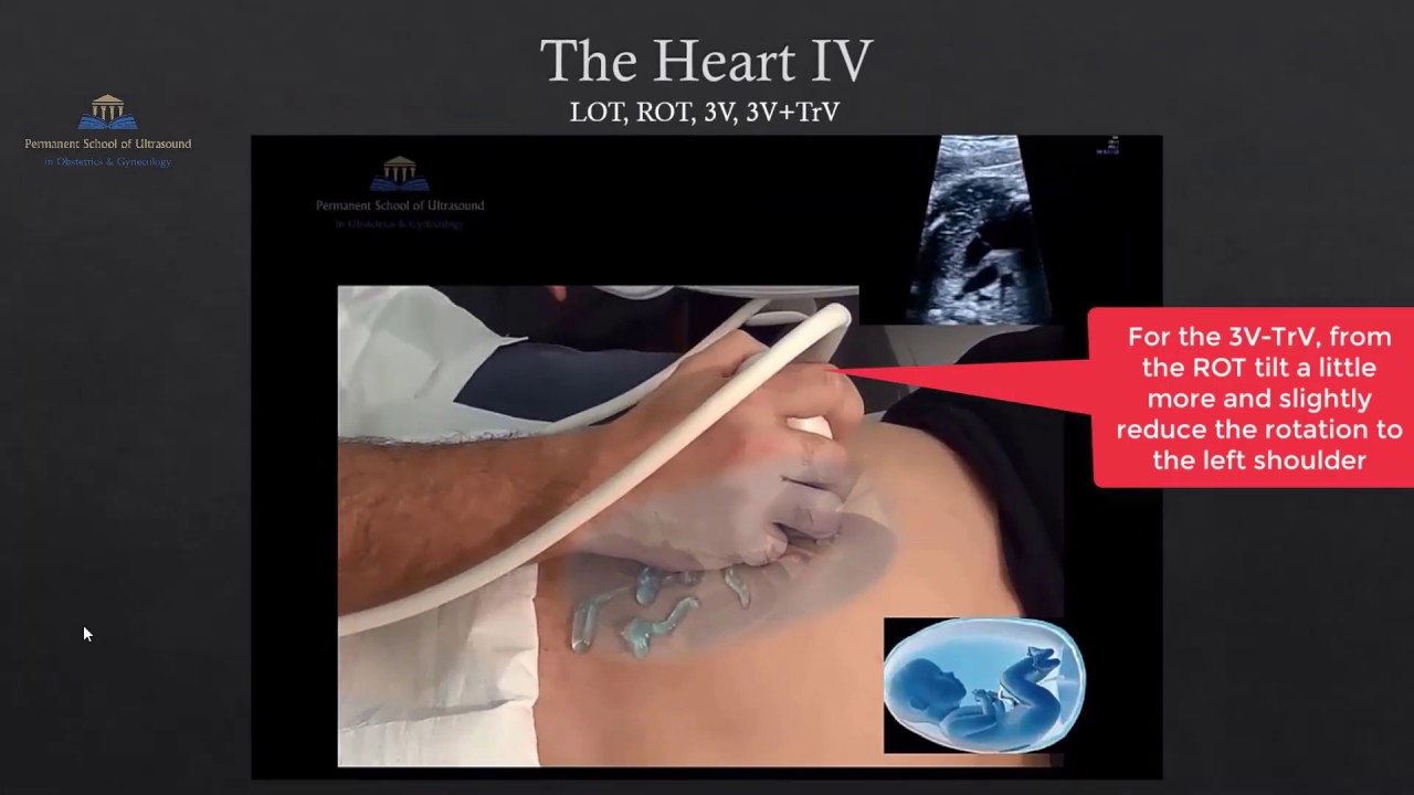Fetal Anomaly Scan Methodology - PSUOG