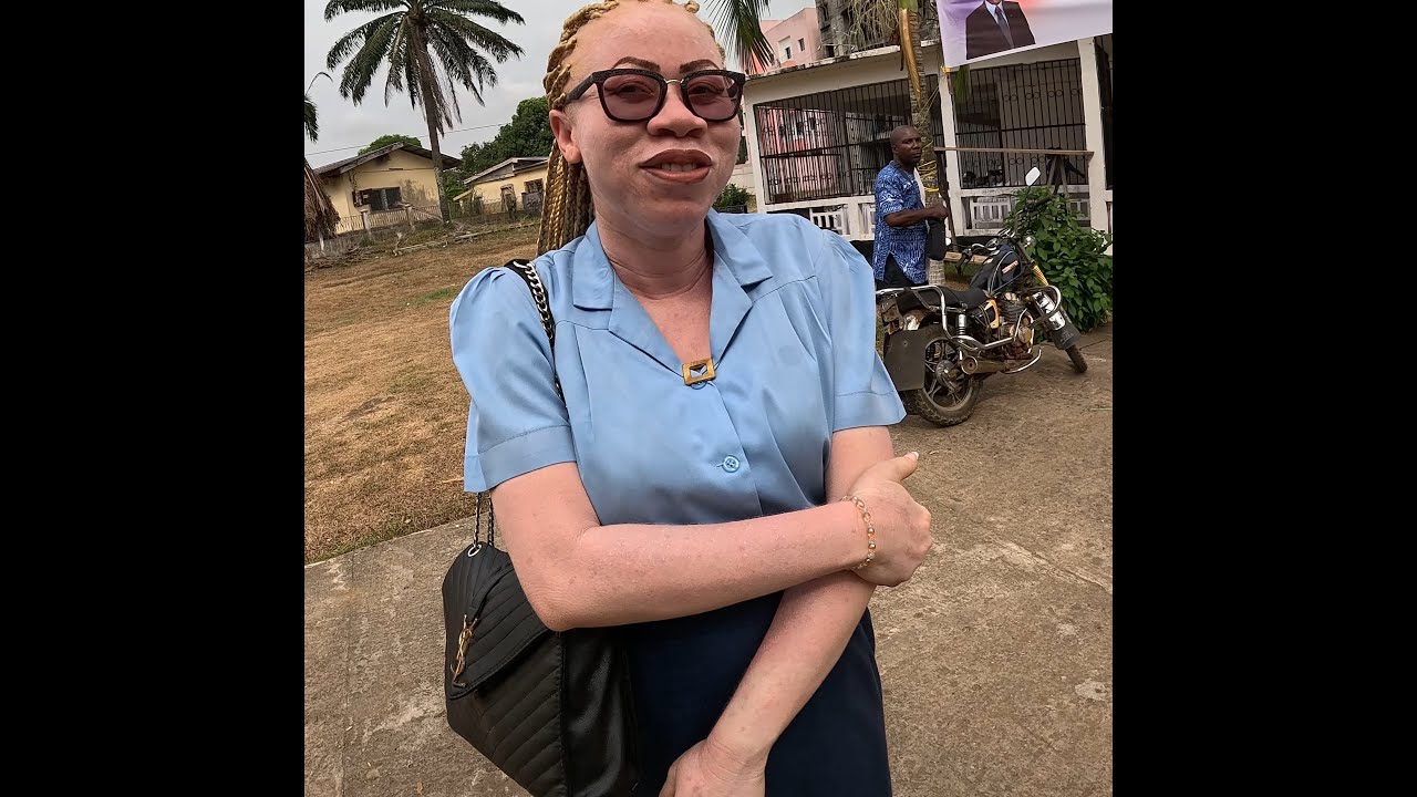 Albinos a Kribi   Cameroun
