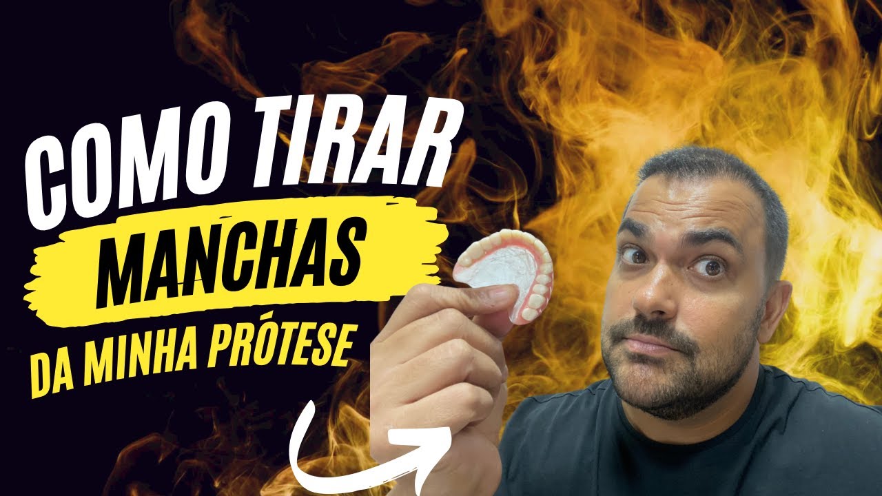 Se a sua PRÓTESE está MANCHADA, VELHA e FEIA, assista a esse Vídeo!