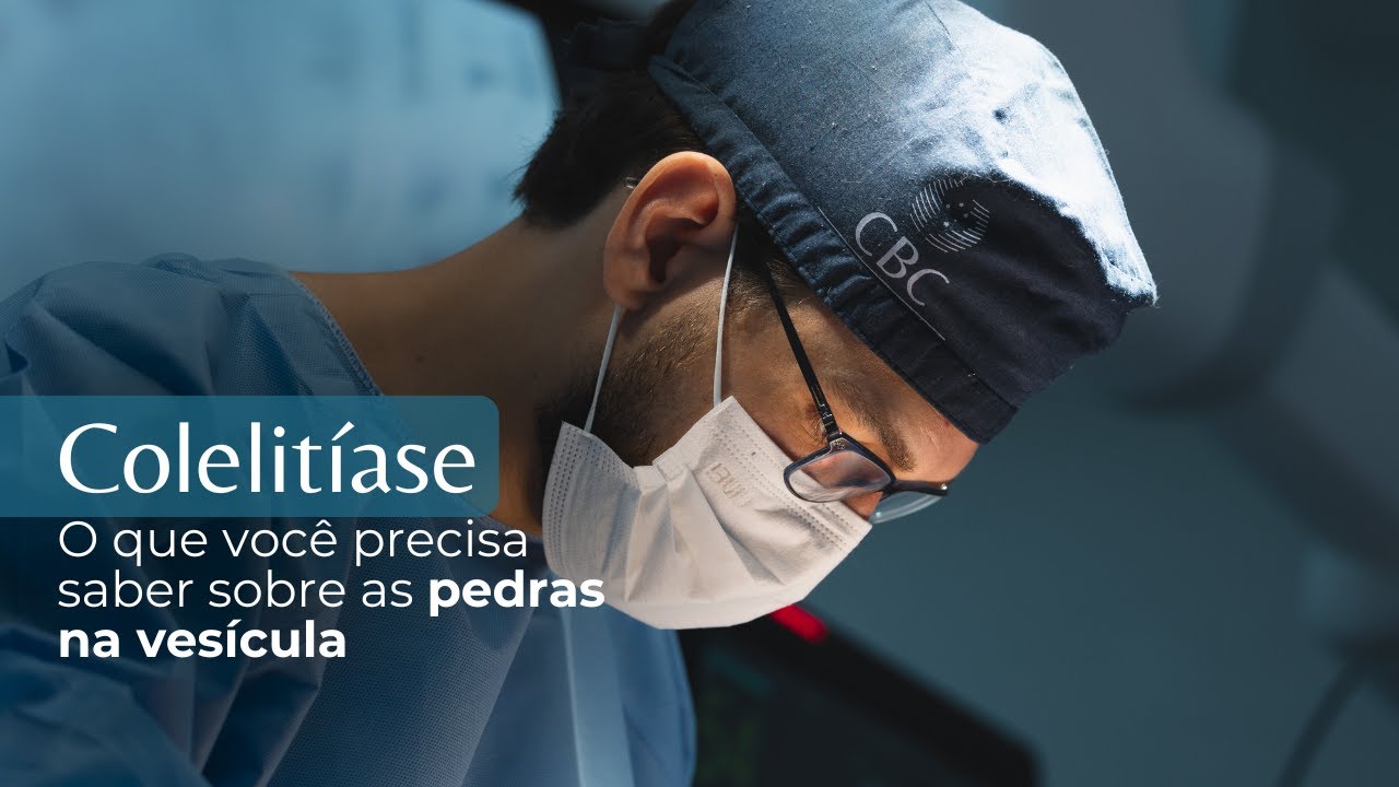 Pedra na vesícula e a cirurgia de retirada da vesícula