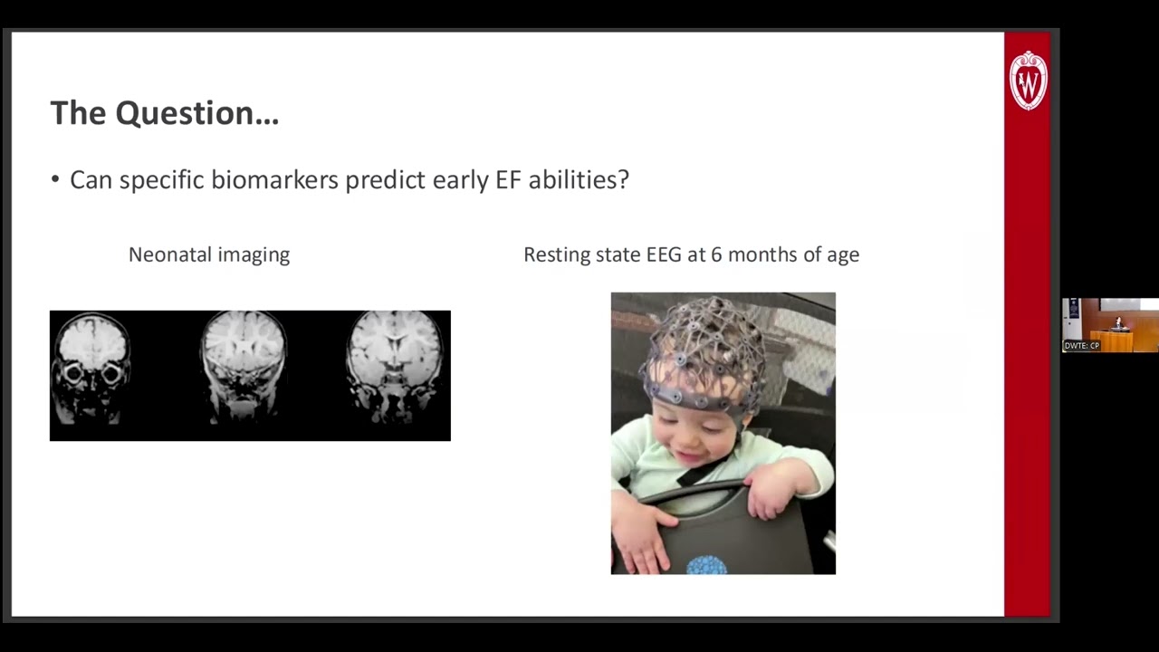 2024 Day with the Experts: Cerebral Palsy - Melisa Carrasco McCaul, MD, PhD