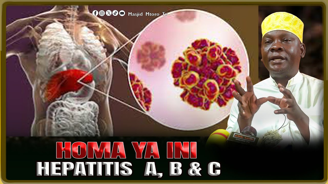 MAAJABU YA DAWA INAYOTIBIA HOMA YA INI ( HEPATITIS A, B, C ) | SHEIKH KHAMIS SULEYMAN