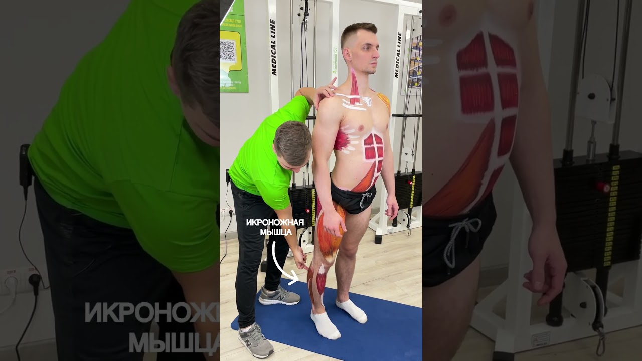 Почему у вас ЦЕЛЛЮЛИТ и ВЫПЯЧИВАЕТСЯ ЖИВОТ? #shorts #таз #целлюлит