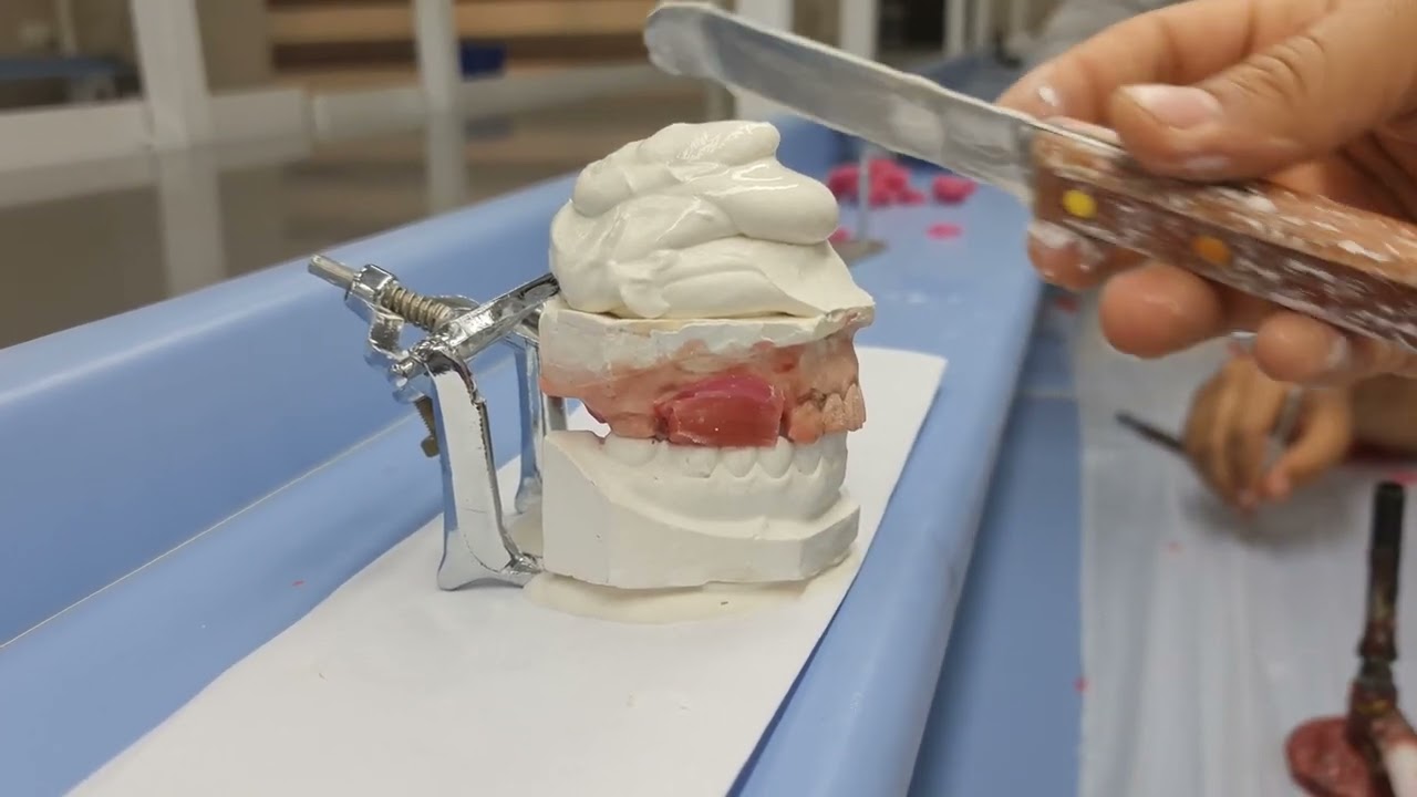 Mounting  simple  articulater for Removable partial denture