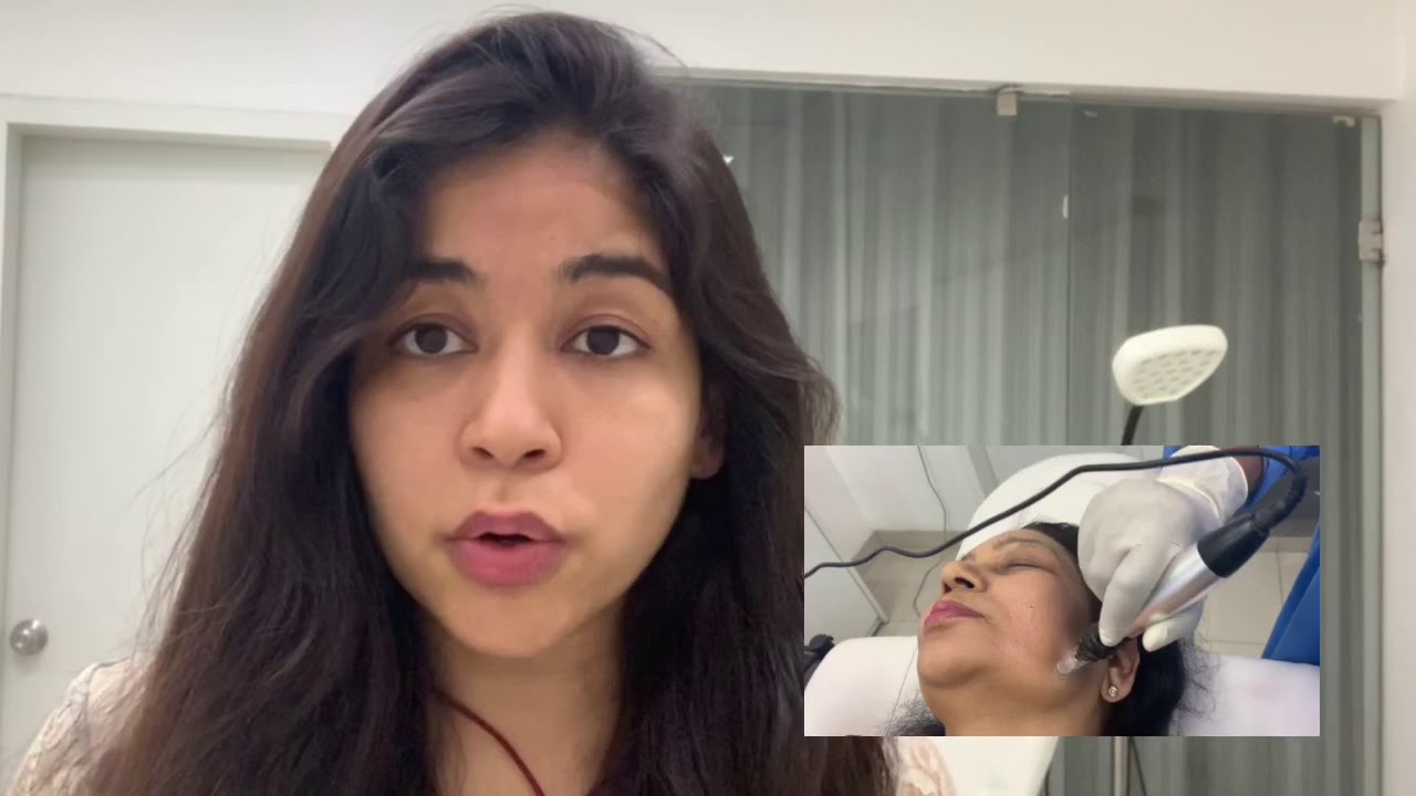(Hindi ) Microneedling -For Skin Glow and Scars