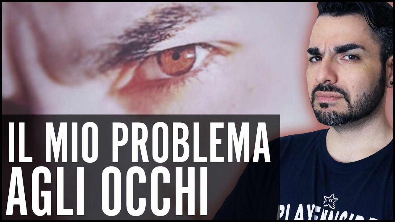Il mio problema agli occhi... (Gravi Miodesopsie o Floaters)