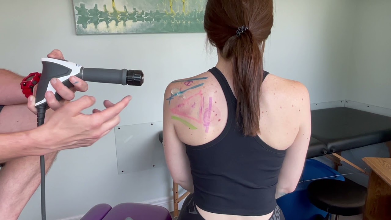 Best Shoulder Pain Treatment: Rotator Cuff Injury Relief with Shockwave Therapy | Dr. Steve Knighton