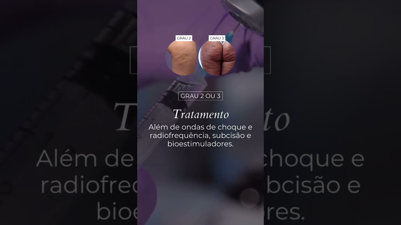 QUAL O GRAU DA SUA CELULITE? #dermatologia #cuidadoscomapele #rotinadecuidados #celulite
