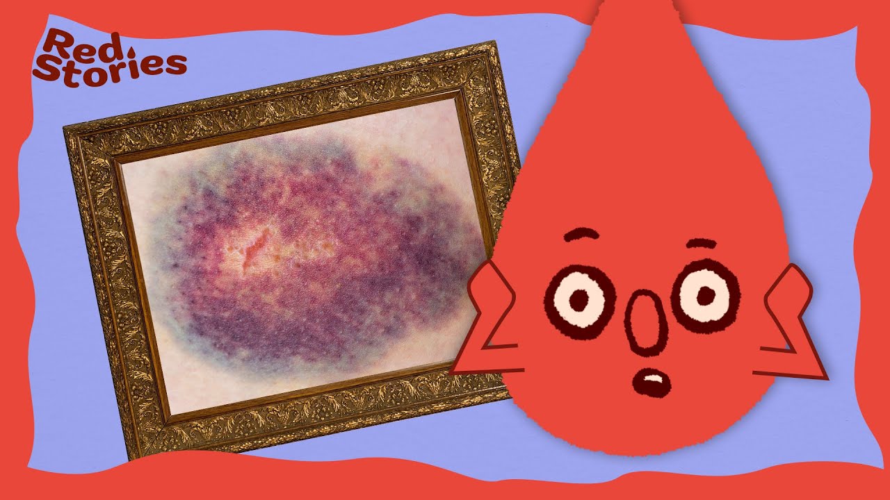 DEAR BODY: Wie entstehen blaue Flecken? - Red Stories