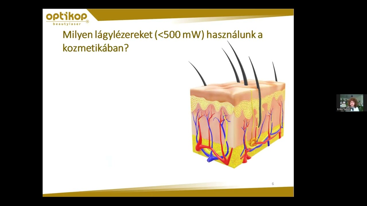 Problémás bőr kezelése az Optikop Beautylaser innovatív megoldásával - Tábori Erika
