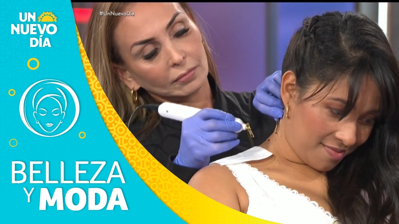 Fibroblast: Elimina verrugas rápidamente y sin dolor | Un Nuevo Día | Telemundo