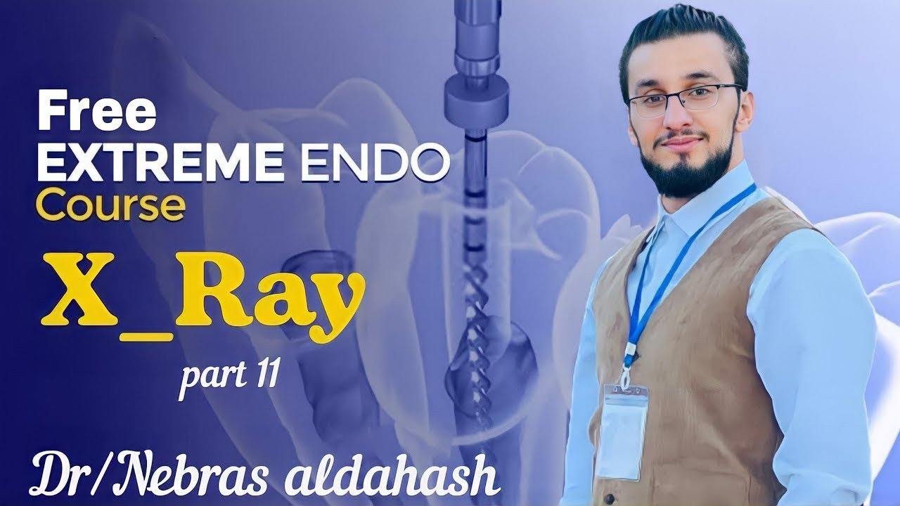 Endodontic X-Ray Discussion