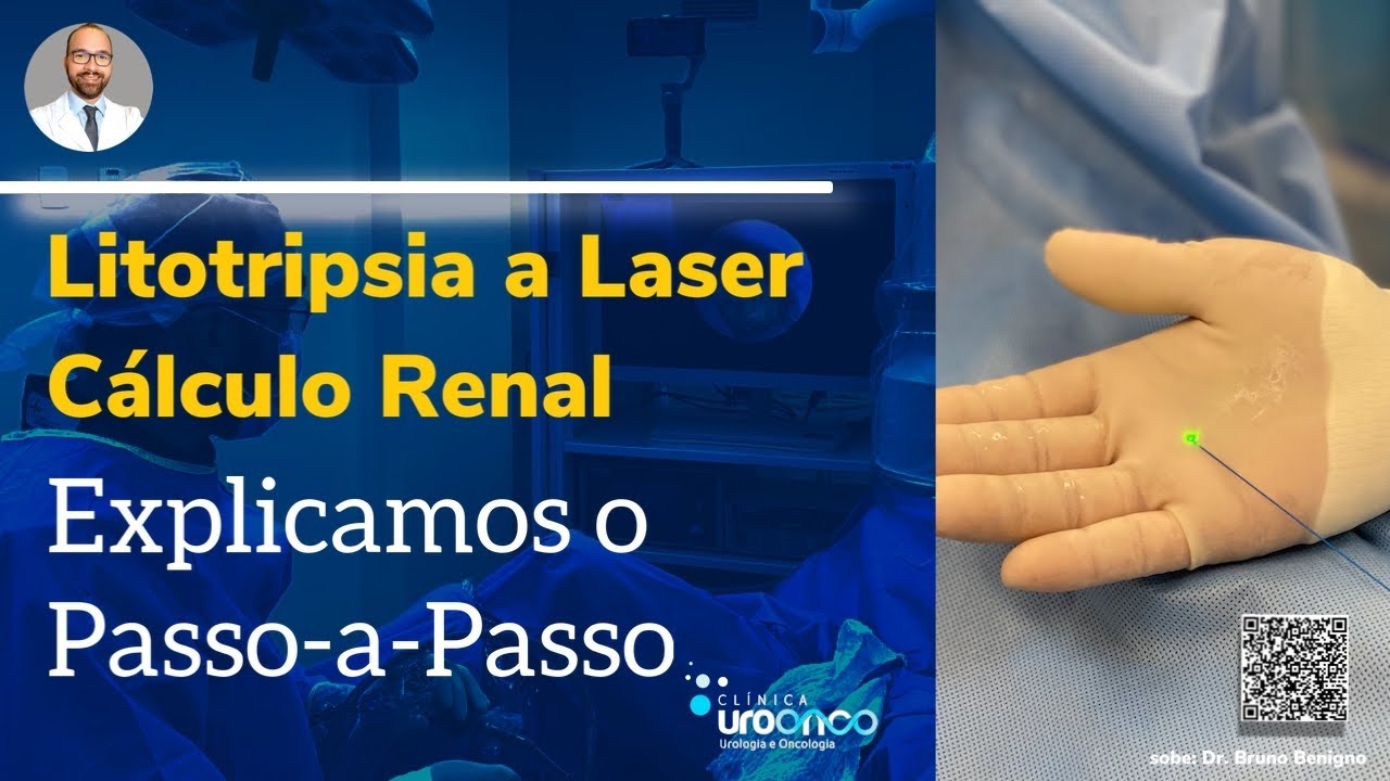 Litotripsia a Laser Explicada Passo a Passo. Entenda o tratamento de pedras nos rins.