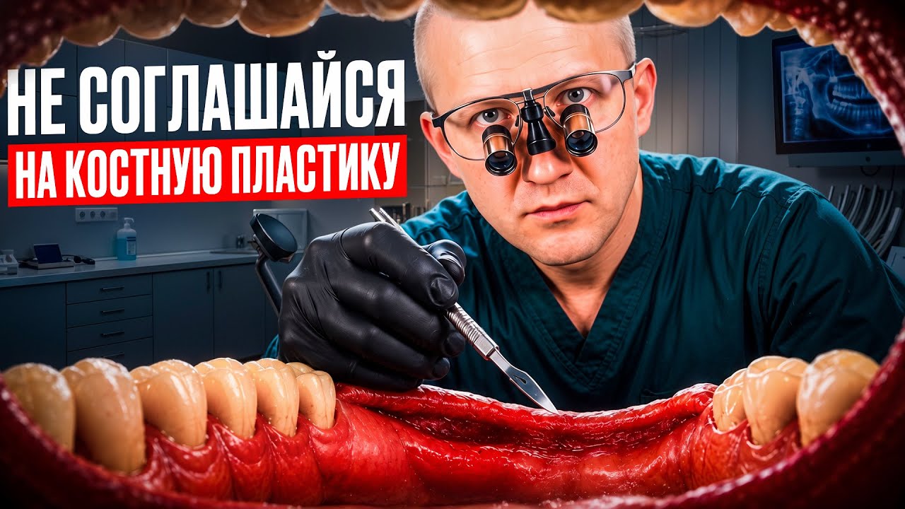 👆 Остеопластика - наращивание костной ткани