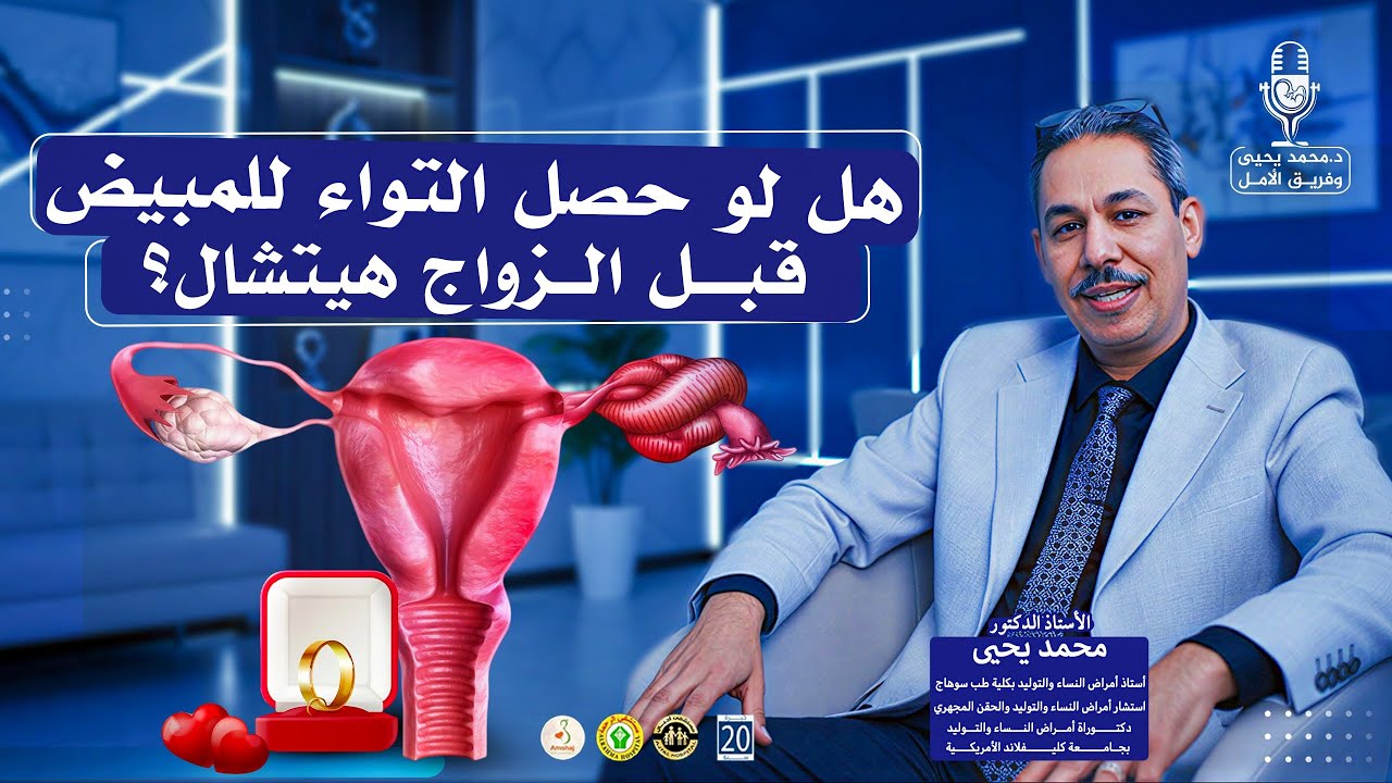 هل التواء المبيض خطير لو حصل قبل الزواج؟