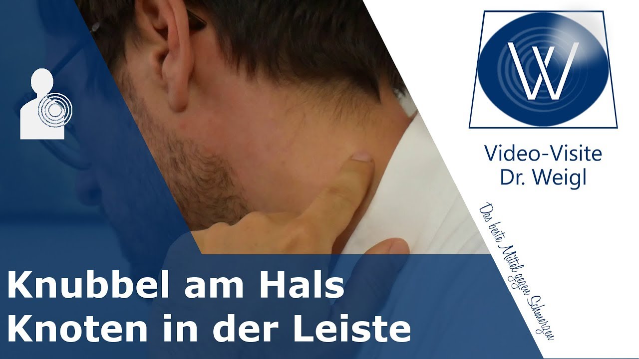 Knubbel hinterm Ohr, am Hals & Knoten in der Leiste: Sind geschwollene Lymphknoten gefährlich?