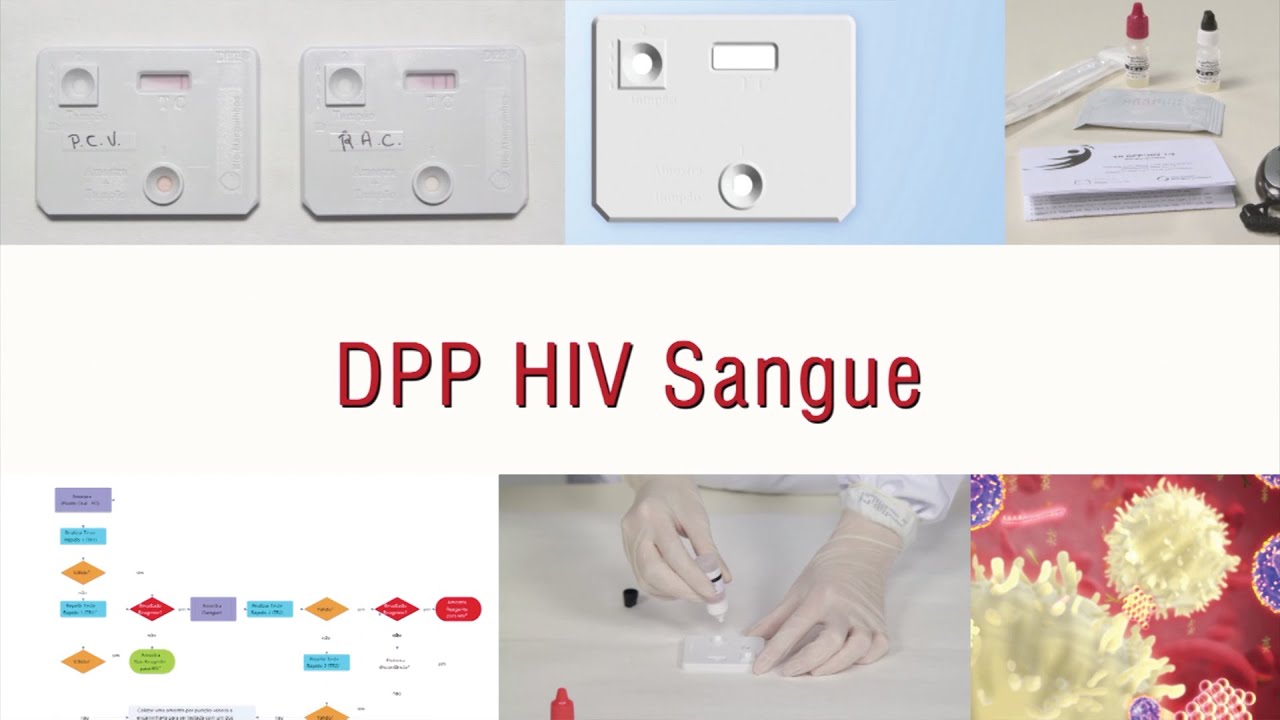 DPP HIV -  Sangue