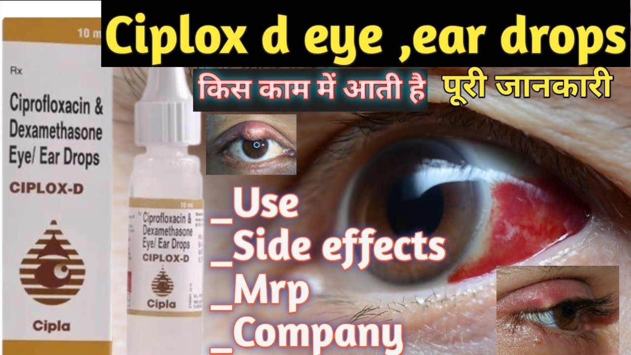 Ciplox d eye, ear drops Use in hindi || Ciplox d || @VinayPharmacy08 #ciplox 