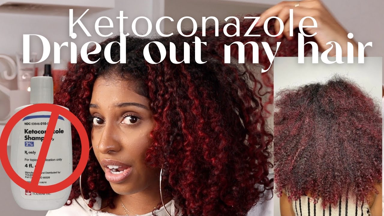 Why I DON'T recommend Ketoconazole for CURLY or NATURAL hair| For dry, itchy, irritated scalps.
